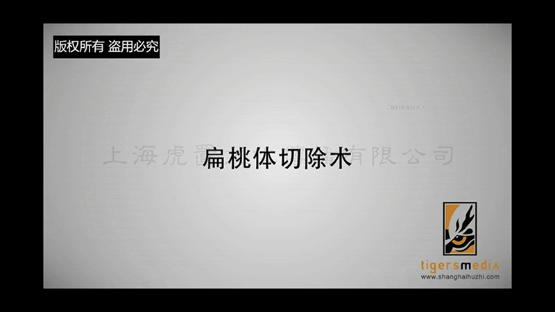 Tonsillectomy Surgery Animation