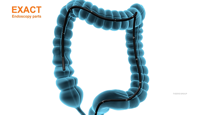 Colonoscopy Medical Animation